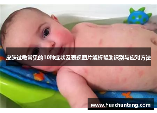 皮肤过敏常见的10种症状及表现图片解析帮助识别与应对方法